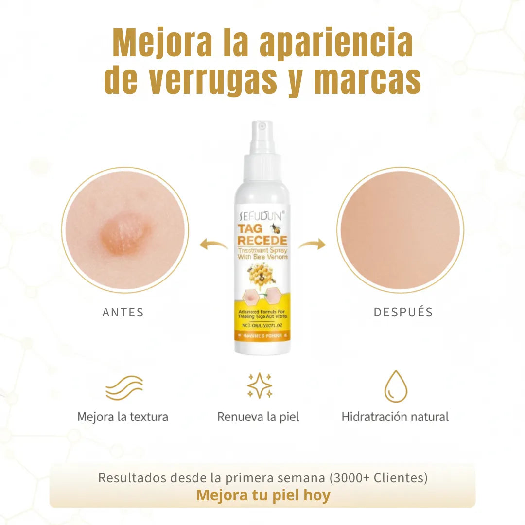 Tag Recede - Spray eliminador de verrugas de veneno de abeja - 60ml