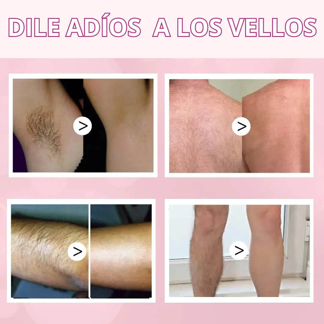 Smooth and Hairless -  Crema Depilatoria Corporal Suave y Sin Irritación Cuerpo y Rostro